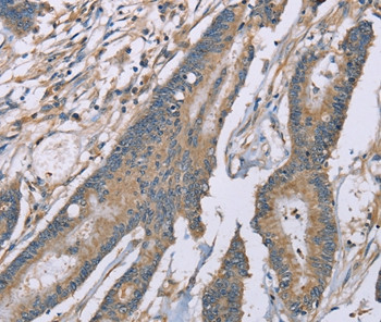 SASH1 Antibody in Immunohistochemistry (Paraffin) (IHC (P))