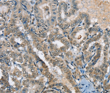 SEPN1 Antibody in Immunohistochemistry (Paraffin) (IHC (P))