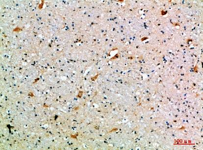 SEMA7A Antibody in Immunohistochemistry (Paraffin) (IHC (P))