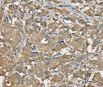 SERPINA11 Antibody in Immunohistochemistry (Paraffin) (IHC (P))