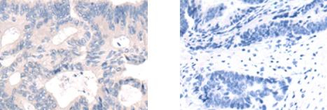SIGLEC15 Antibody in Immunohistochemistry (Paraffin) (IHC (P))