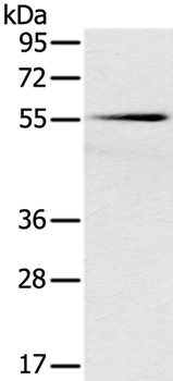 SLC16A10 Antibody in Western Blot (WB)