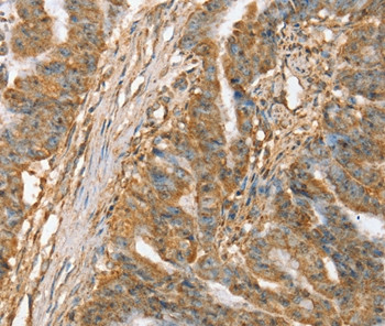 SLC41A3 Antibody in Immunohistochemistry (Paraffin) (IHC (P))