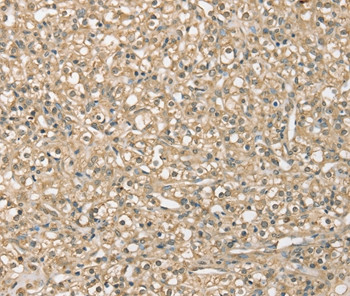 SMAGP Antibody in Immunohistochemistry (Paraffin) (IHC (P))