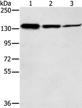 SMC2 Antibody in Western Blot (WB)