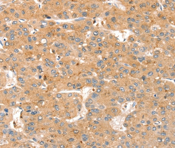 SMOC2 Antibody in Immunohistochemistry (Paraffin) (IHC (P))