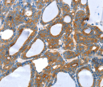SNX5 Antibody in Immunohistochemistry (Paraffin) (IHC (P))