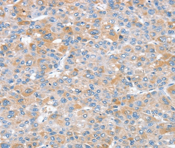 SNX25 Antibody in Immunohistochemistry (Paraffin) (IHC (P))