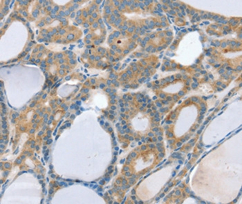SNX29 Antibody in Immunohistochemistry (Paraffin) (IHC (P))