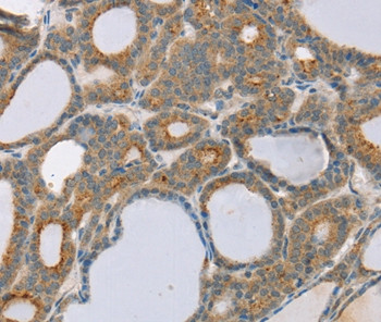 SNX30 Antibody in Immunohistochemistry (Paraffin) (IHC (P))