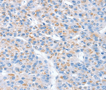 SNX33 Antibody in Immunohistochemistry (Paraffin) (IHC (P))