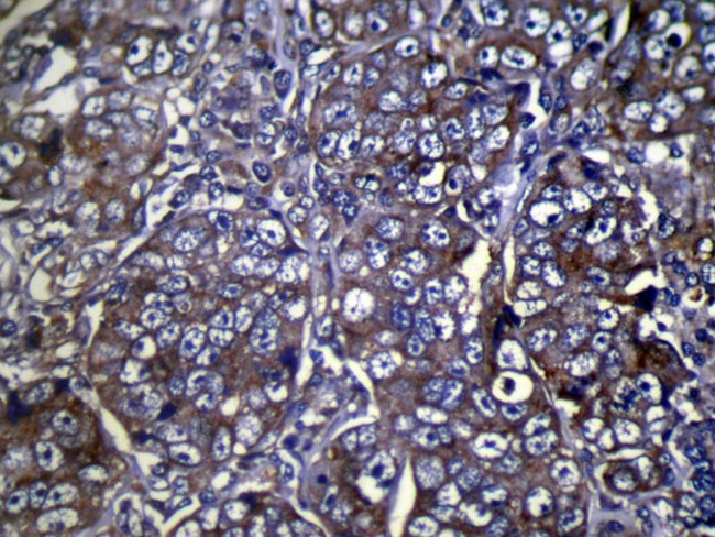 COLEC11 Antibody in Immunohistochemistry (Paraffin) (IHC (P))