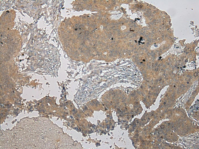 CENPM Antibody in Immunohistochemistry (Paraffin) (IHC (P))