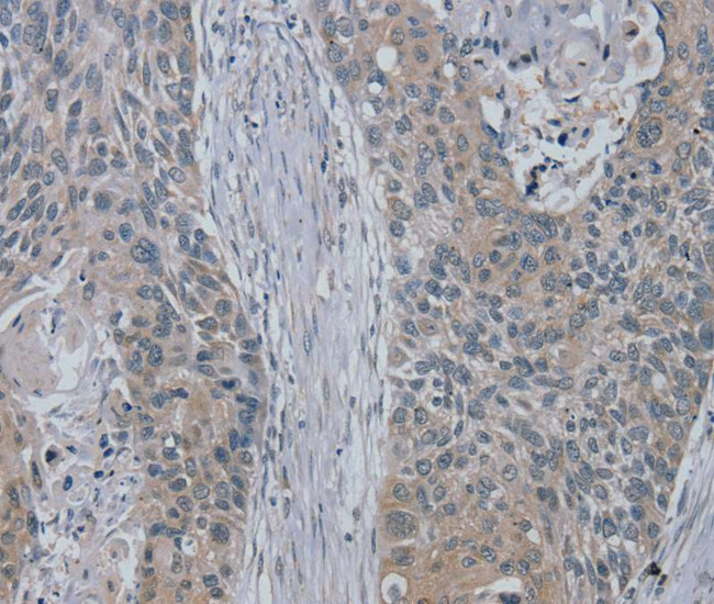RASA4 Antibody in Immunohistochemistry (Paraffin) (IHC (P))