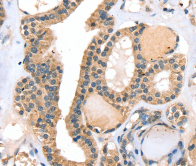 RASGEF1A Antibody in Immunohistochemistry (Paraffin) (IHC (P))