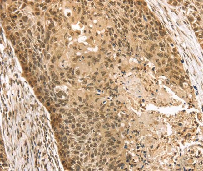 STAG2 Antibody in Immunohistochemistry (Paraffin) (IHC (P))