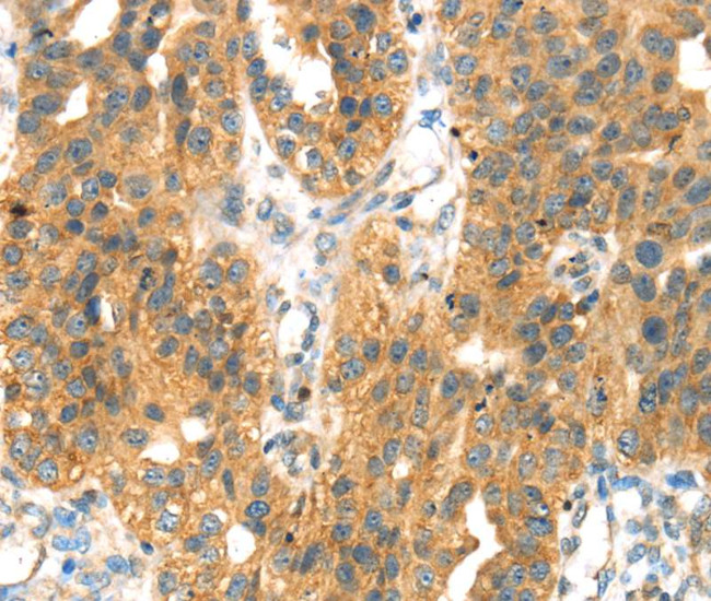 SEPP1 Antibody in Immunohistochemistry (Paraffin) (IHC (P))