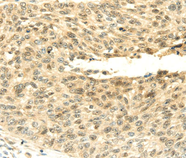 SHPRH Antibody in Immunohistochemistry (Paraffin) (IHC (P))