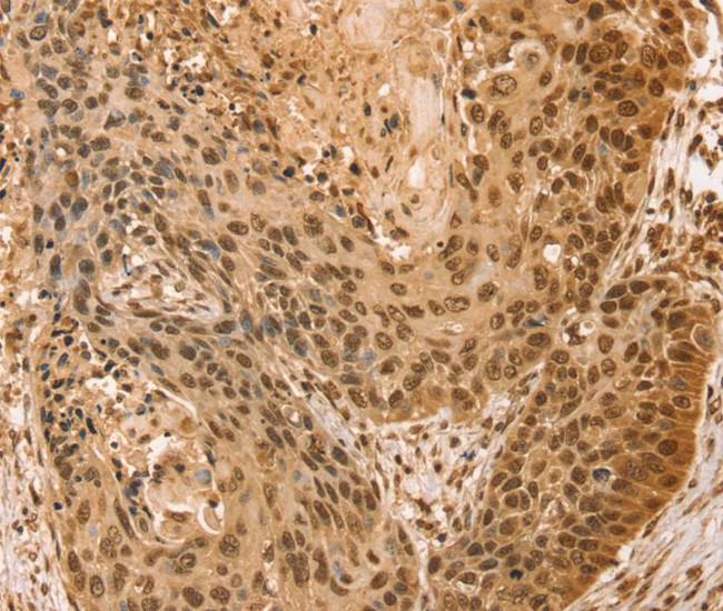 SNX8 Antibody in Immunohistochemistry (Paraffin) (IHC (P))