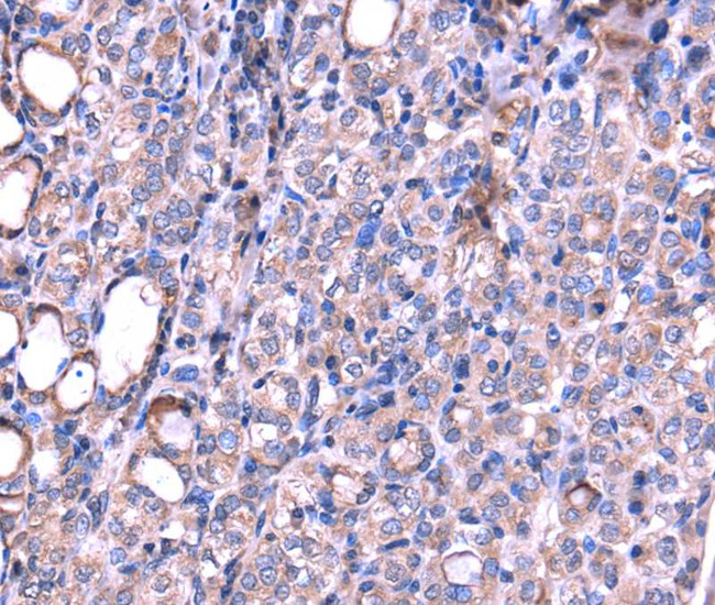 SRPK3 Antibody in Immunohistochemistry (Paraffin) (IHC (P))