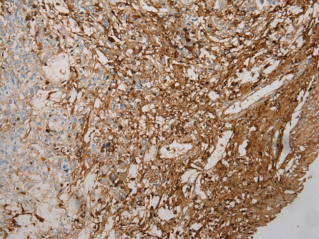 STX18 Antibody in Immunohistochemistry (Paraffin) (IHC (P))
