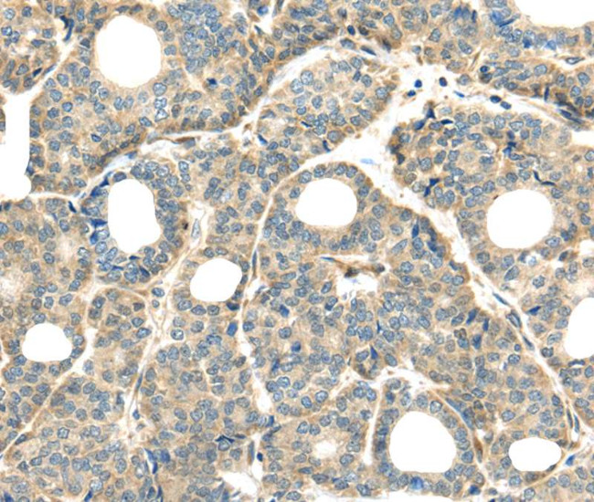 THAP2 Antibody in Immunohistochemistry (Paraffin) (IHC (P))