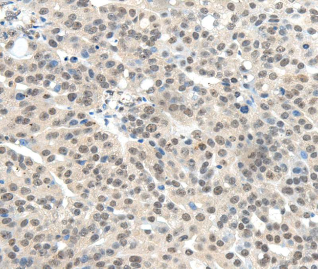 RNF92 Antibody in Immunohistochemistry (Paraffin) (IHC (P))