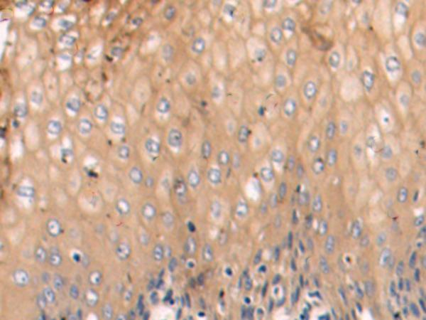 TRIM14 Antibody in Immunohistochemistry (Paraffin) (IHC (P))