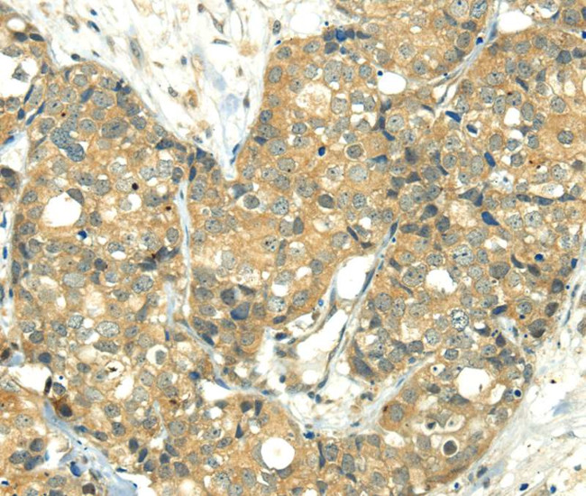 TRIM10 Antibody in Immunohistochemistry (Paraffin) (IHC (P))