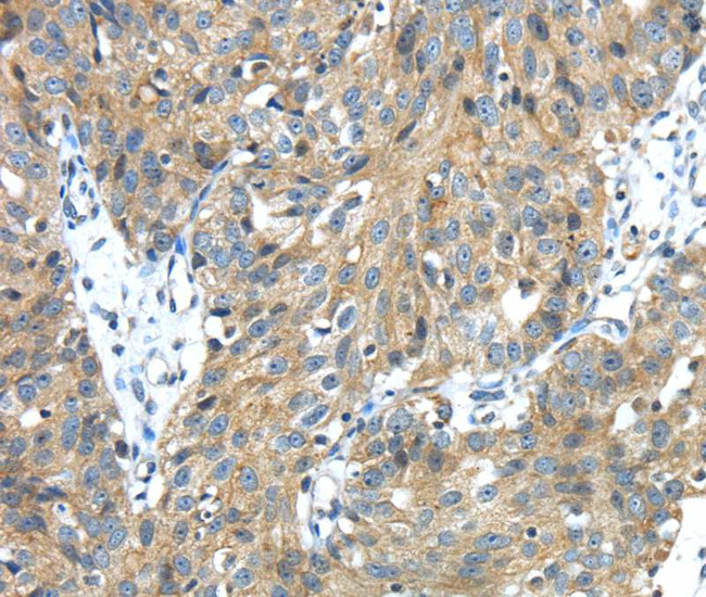 TMPRSS13 Antibody in Immunohistochemistry (Paraffin) (IHC (P))