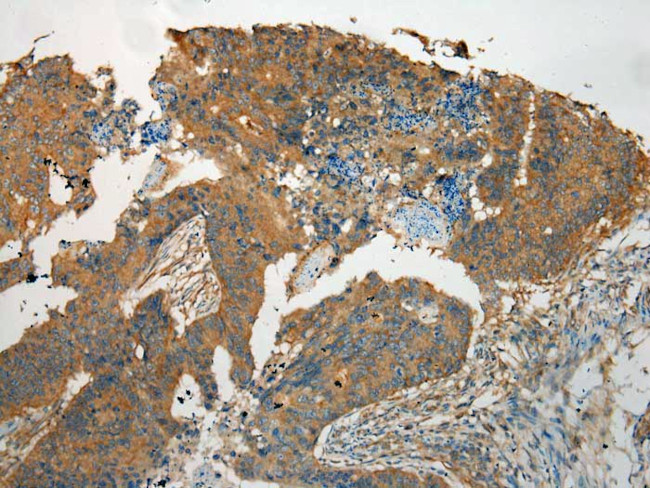 TMPRSS11E Antibody in Immunohistochemistry (Paraffin) (IHC (P))