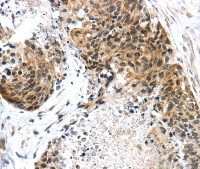 TRIM74 Antibody in Immunohistochemistry (Paraffin) (IHC (P))