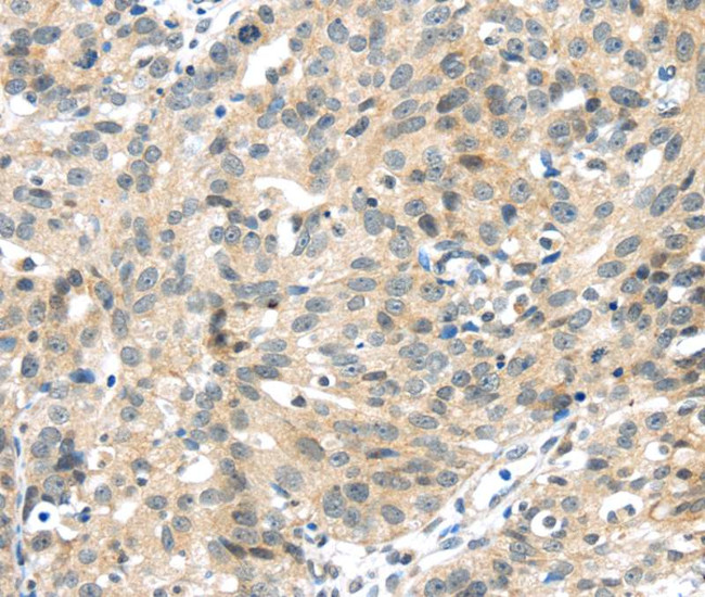 UBL3 Antibody in Immunohistochemistry (Paraffin) (IHC (P))