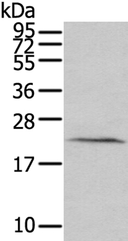 HINT3 Antibody in Western Blot (WB)