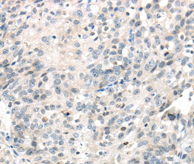 IQGAP2 Antibody in Immunohistochemistry (Paraffin) (IHC (P))
