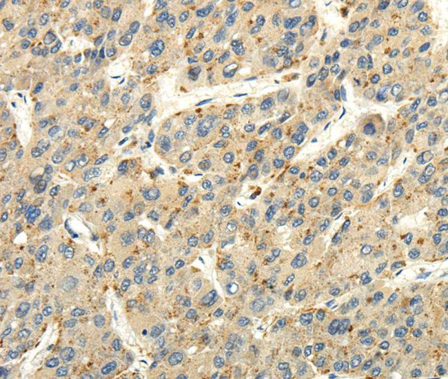 STRA6 Antibody in Immunohistochemistry (Paraffin) (IHC (P))
