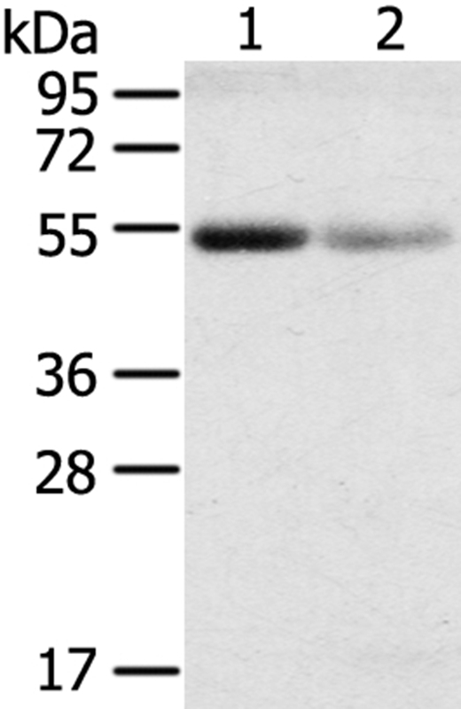 SLC17A1 Antibody in Western Blot (WB)