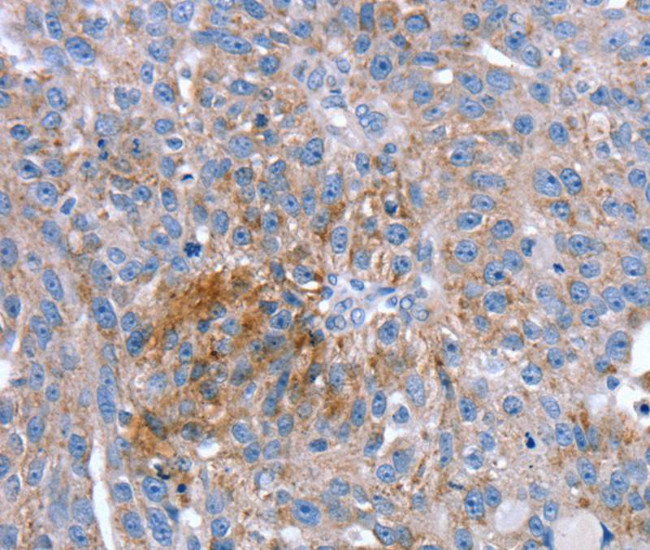 SPATA5L1 Antibody in Immunohistochemistry (Paraffin) (IHC (P))