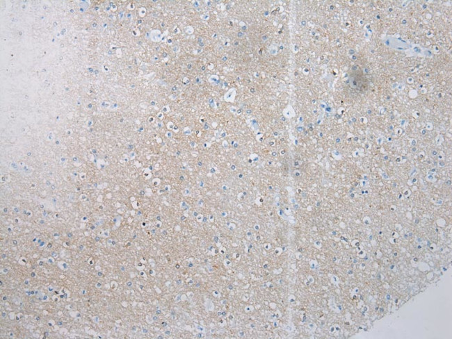 SSX4 Antibody in Immunohistochemistry (Paraffin) (IHC (P))