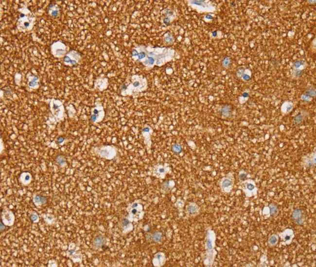 STK32A Antibody in Immunohistochemistry (Paraffin) (IHC (P))