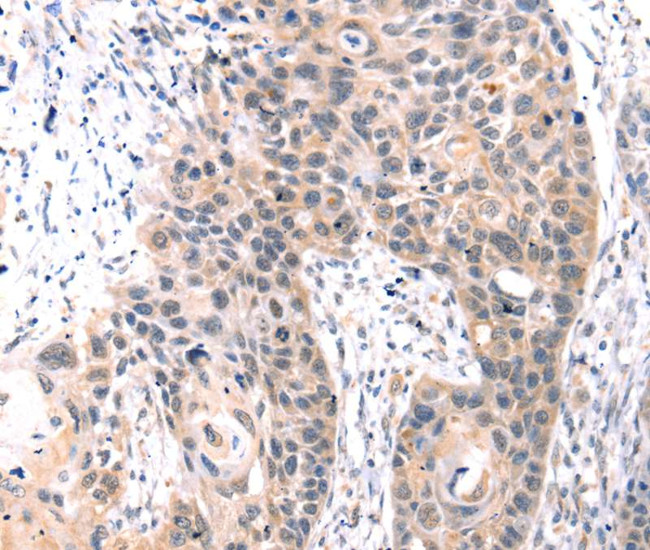 TCERG1L Antibody in Immunohistochemistry (Paraffin) (IHC (P))