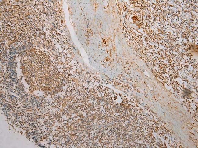 TMPRSS11F Antibody in Immunohistochemistry (Paraffin) (IHC (P))