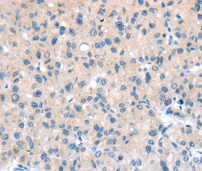 TTI1 Antibody in Immunohistochemistry (Paraffin) (IHC (P))