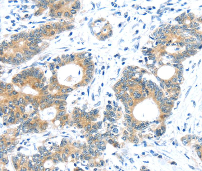 TUSC1 Antibody in Immunohistochemistry (Paraffin) (IHC (P))