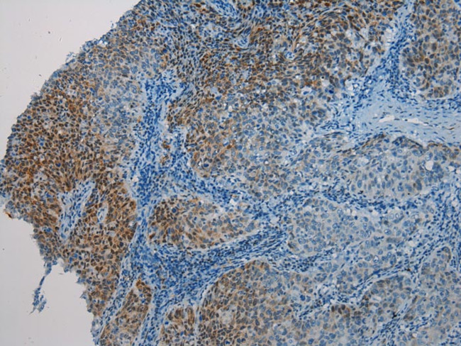 HAUS7 Antibody in Immunohistochemistry (Paraffin) (IHC (P))