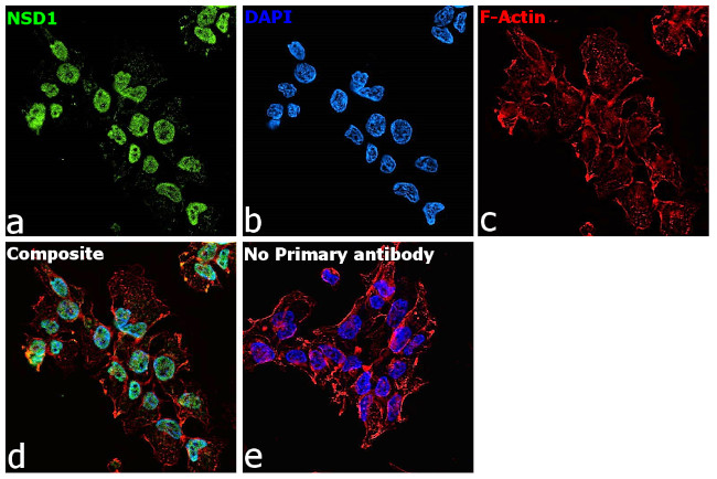 NSD1 Antibody in Immunocytochemistry (ICC/IF)