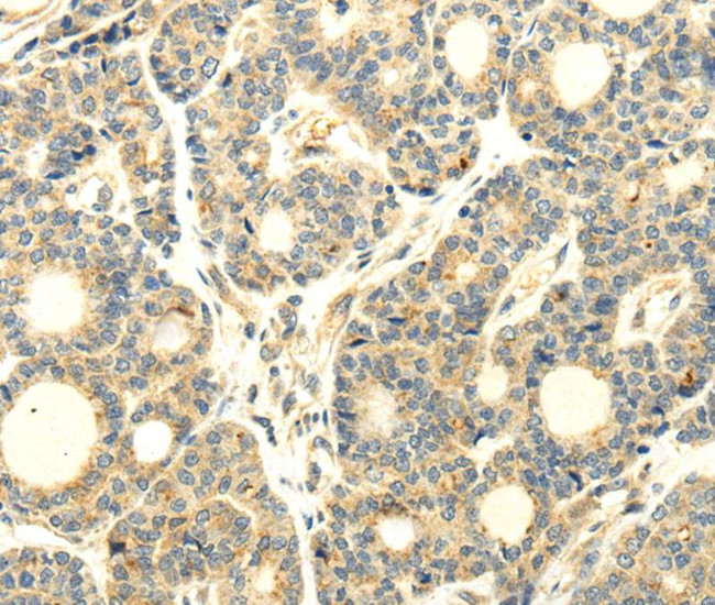 WDR91 Antibody in Immunohistochemistry (Paraffin) (IHC (P))