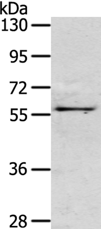 OLFM3 Antibody in Western Blot (WB)