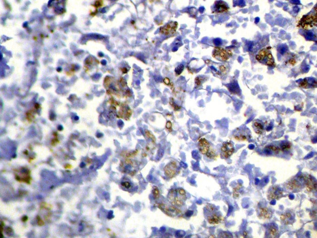 RASAL1 Antibody in Immunohistochemistry (Paraffin) (IHC (P))