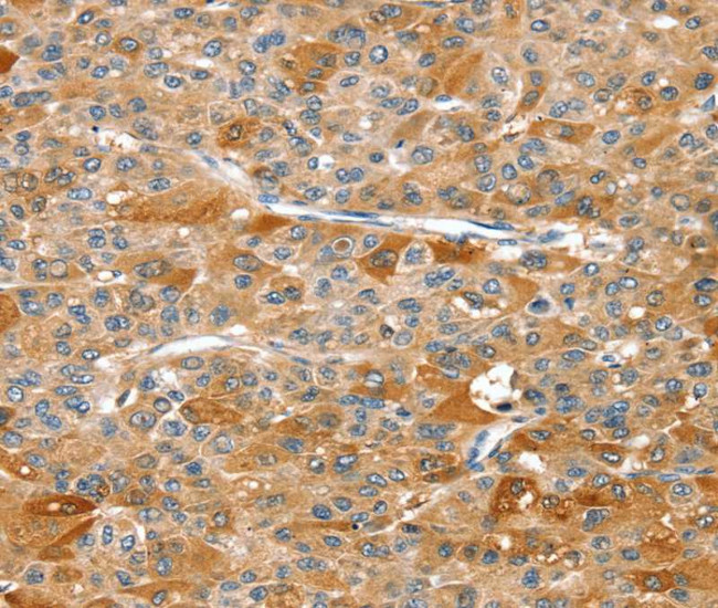 RIPK5 Antibody in Immunohistochemistry (Paraffin) (IHC (P))